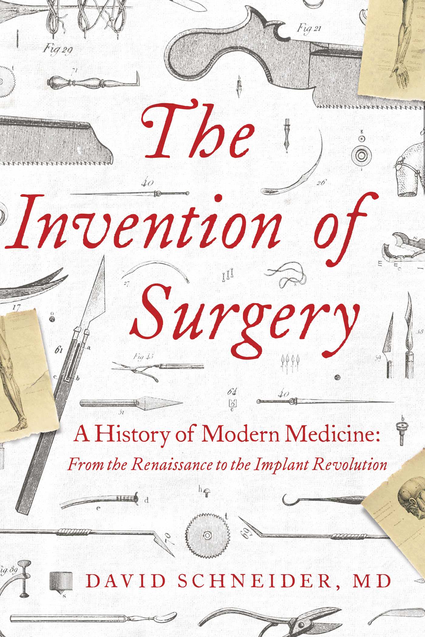 The Invention of Surgery : A History of Modern Medicine: From the Renaissance to the Implant Revolution | Schneider, David